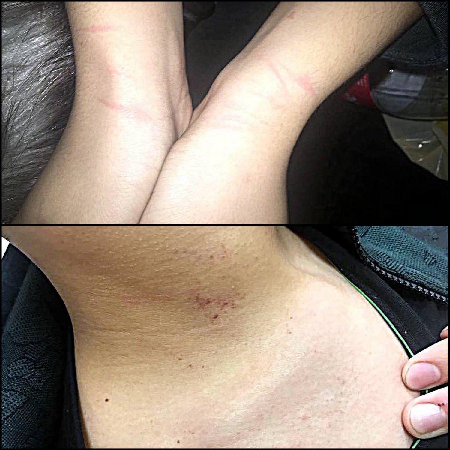 סימני אלימות על הנער. צילום ללא קרדיט