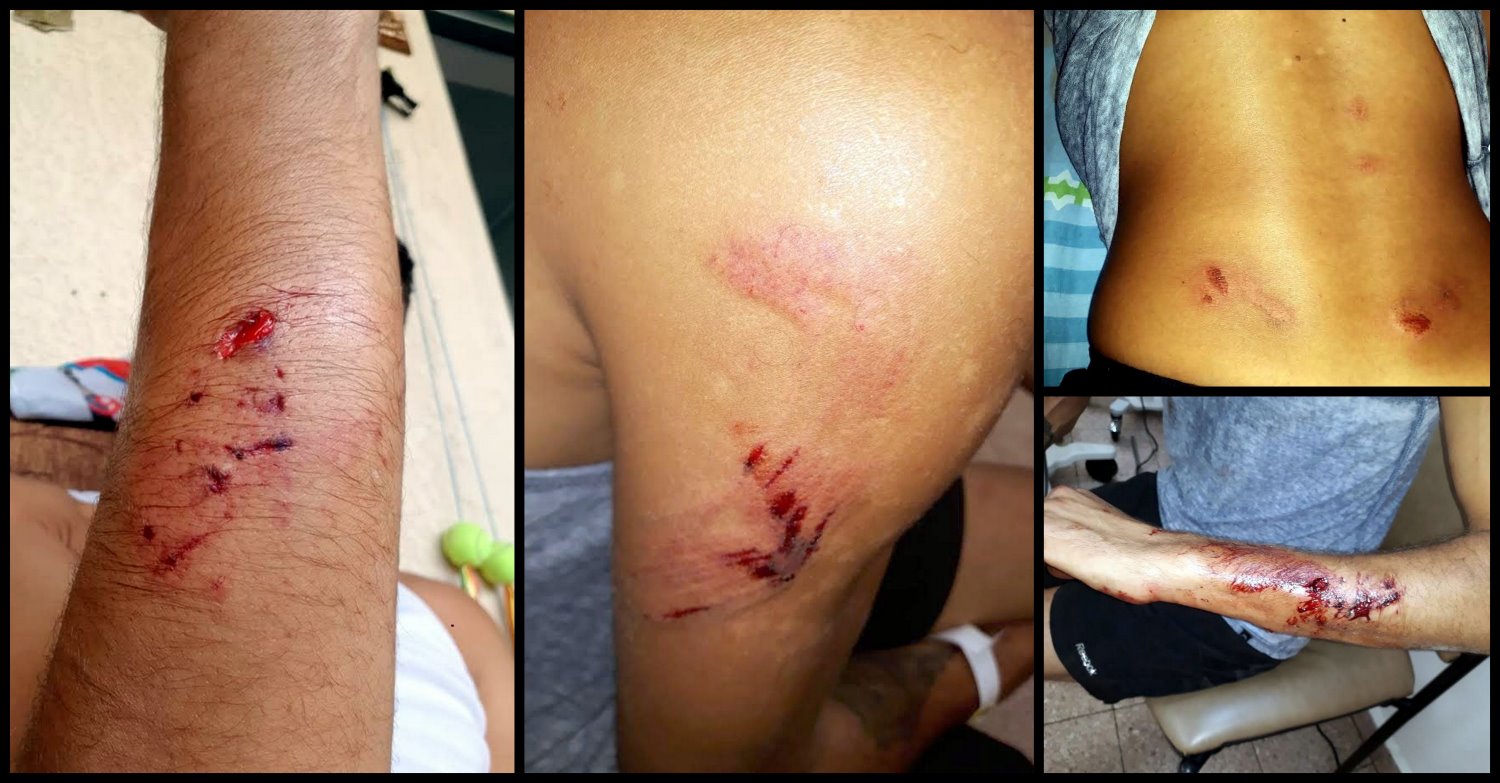 חלק מהפציעות על גופו של נדיר