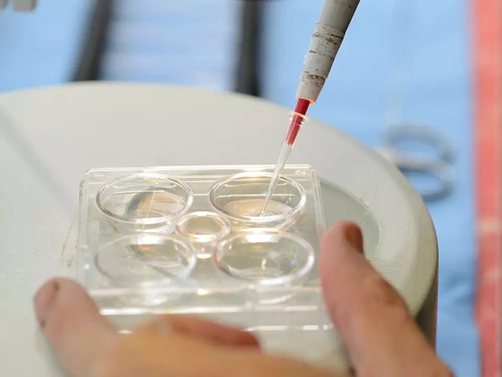 האבחון הוא חלק קריטי בטיפולי הפוריות. צילום: Shutterstock