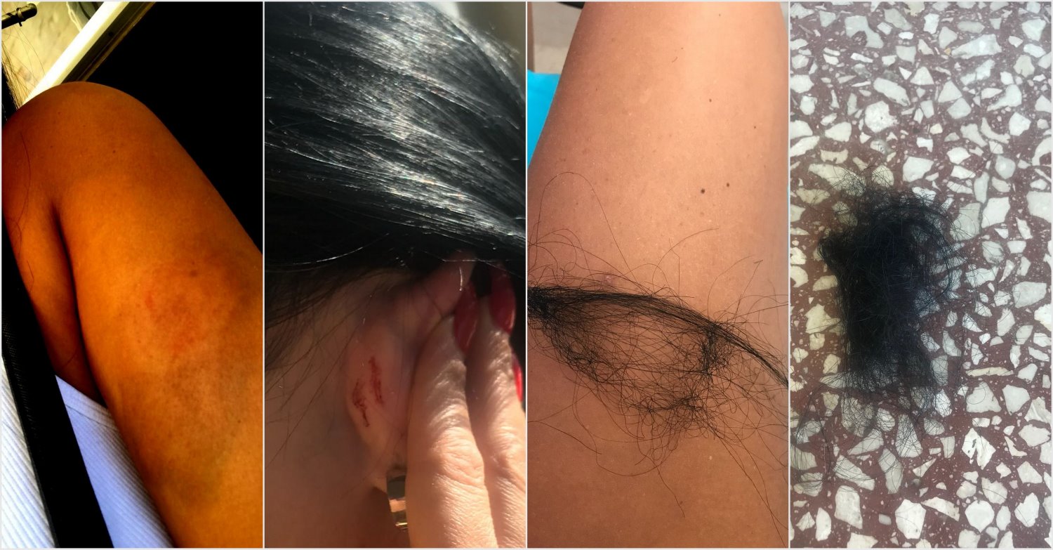 מקרה אלימות קשה בקאנטרי בבאר שבע. צילום: פרטי