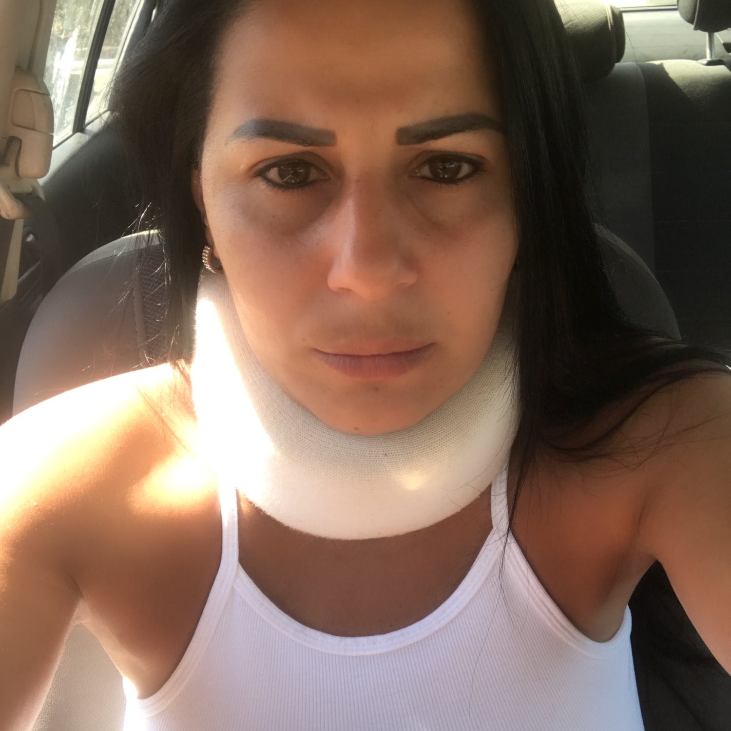 הושיבו אותי על כיסא ומשכו לי את הראש למטה. התנפח לי העורף. צילום: פרטי