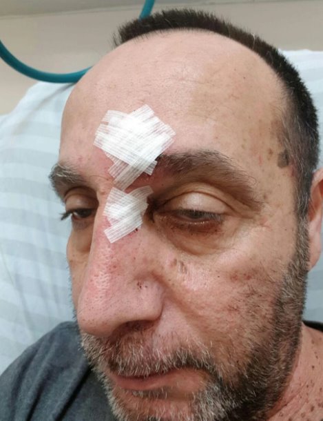 מאיר כהן לאחר אירוע התקיפה. צילום: YNET