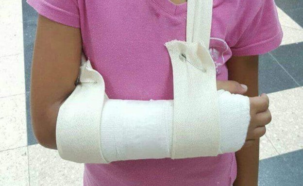 "לקחתי אותה לבית החולים 'סורוקה' והתברר שהיד שלה נשברה"