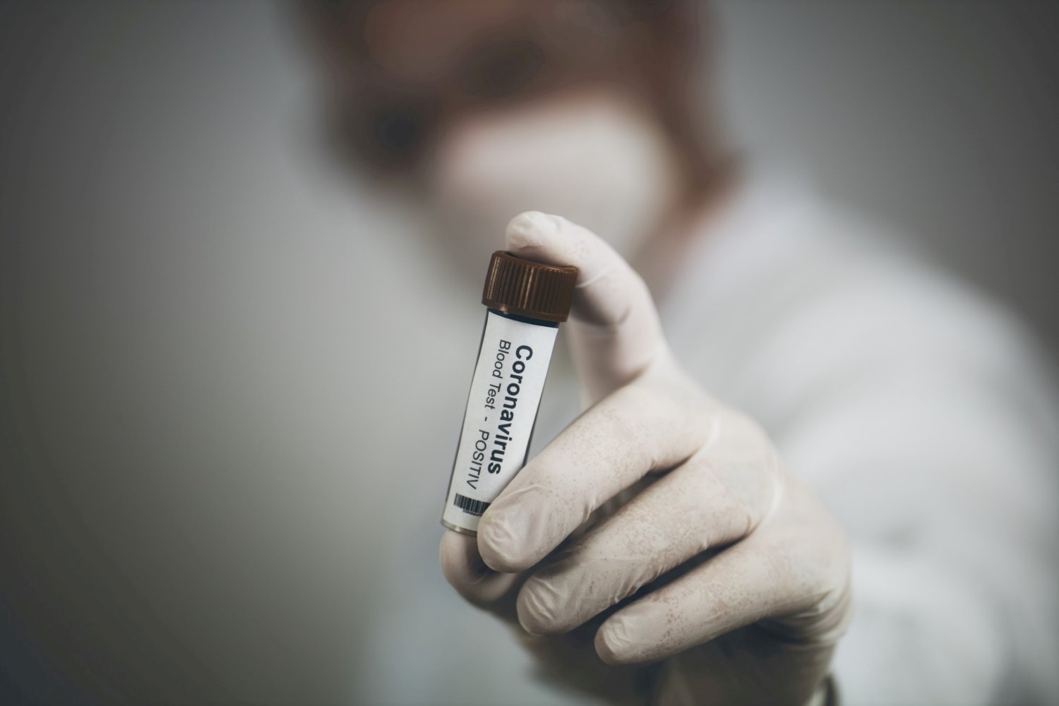 צילום: shutterstock אילוסטרציה 