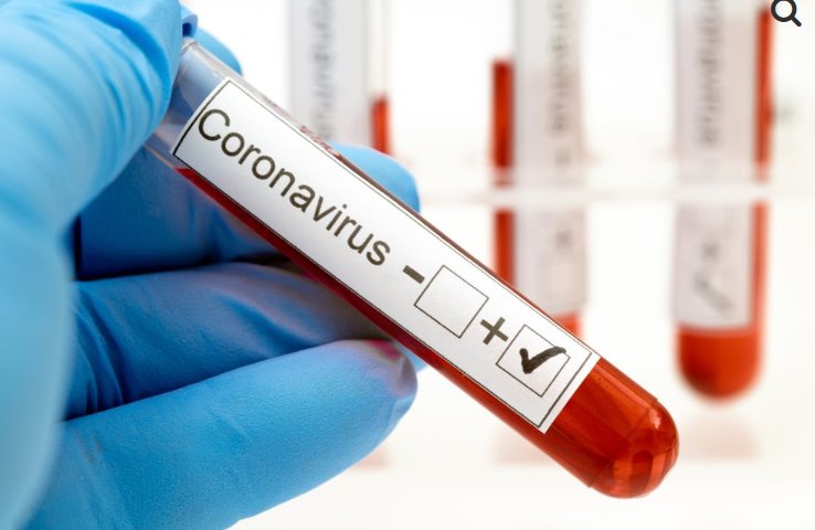 צילום: shutterstock אילוסטרציה