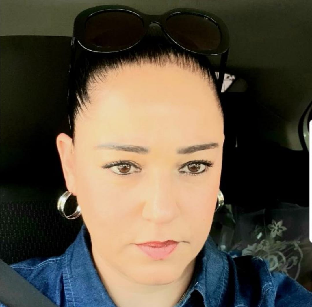 ציפורה חלפון