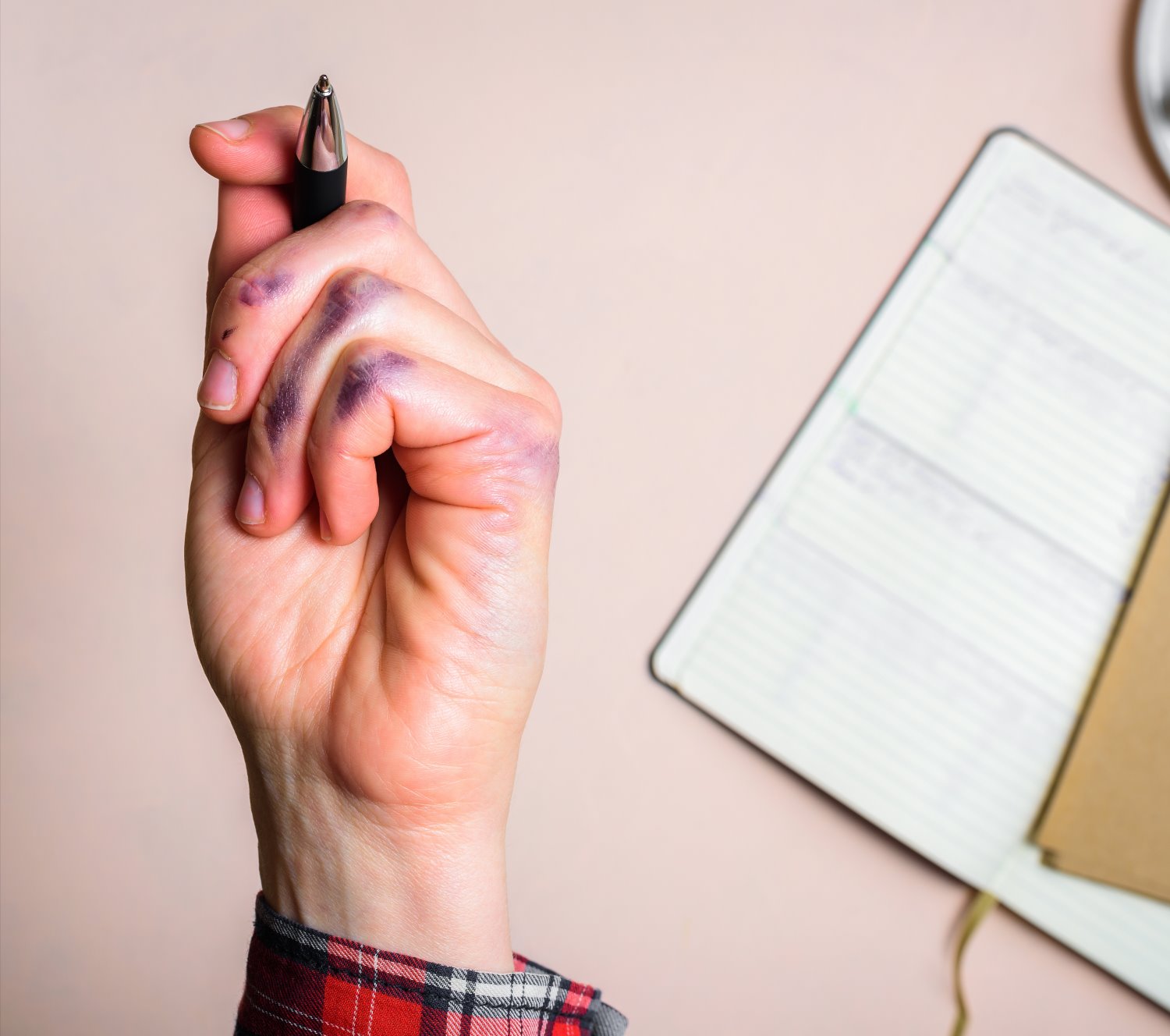 צילום: shutterstock אילוסטרציה 