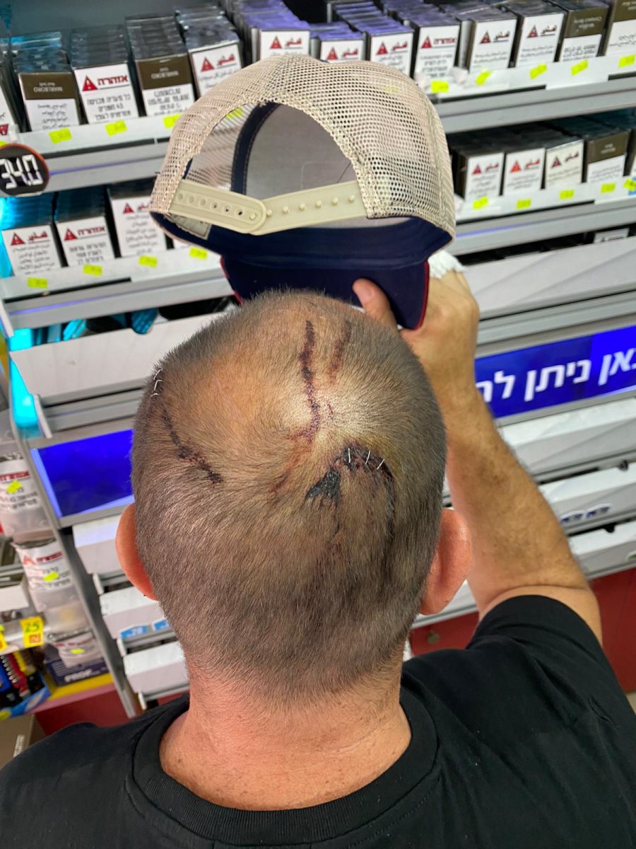 קרדיט - צילום פרטי