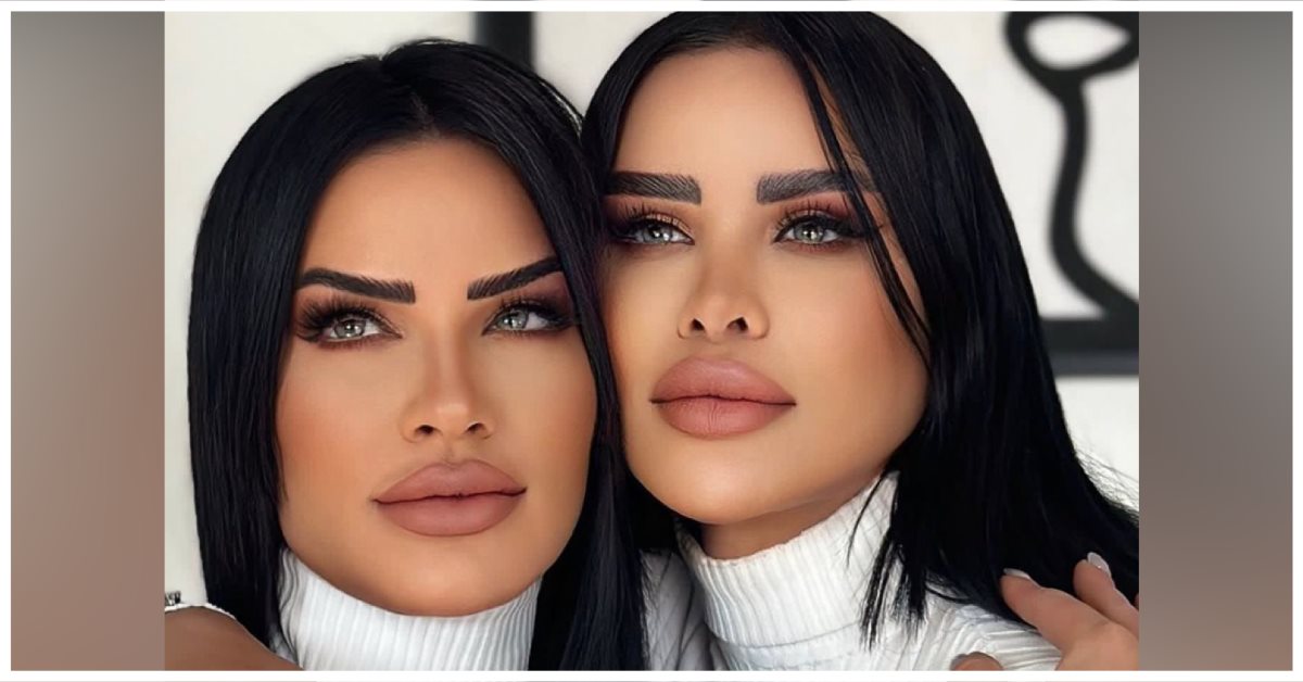 צילום:בלסם אלעוברה