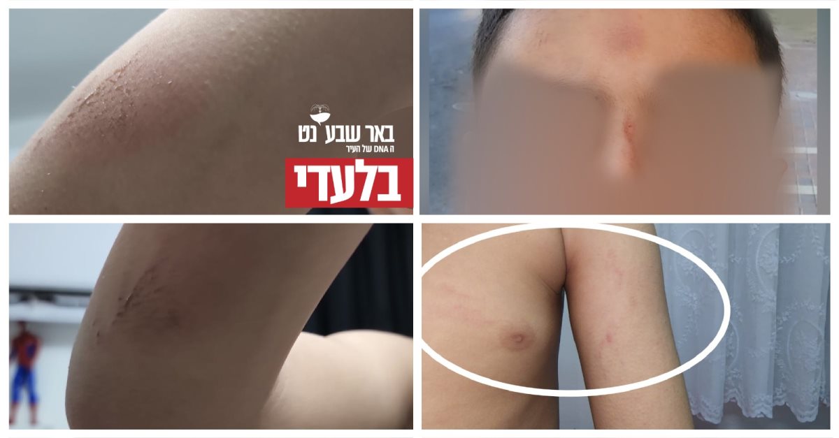 קרדיט - צילום פרטי