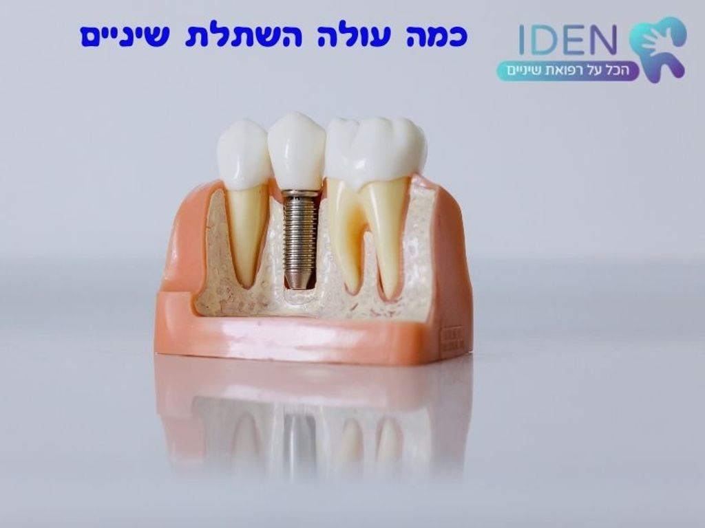 קרדיט התמונה: iden.co.il