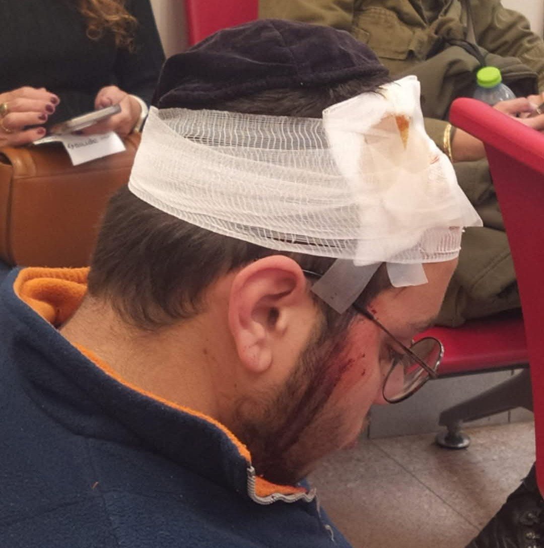 הנער שהותקף. קרדיט: תוכן גולשים ע"פ סעיף 27א'