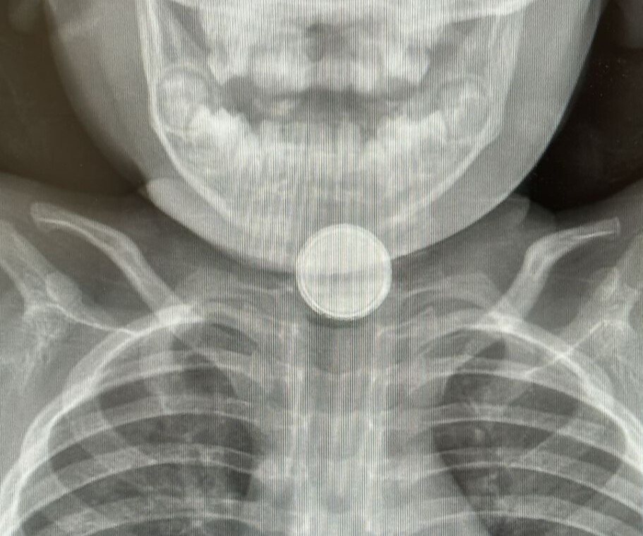 קרדיט: בית החולים סורוקה