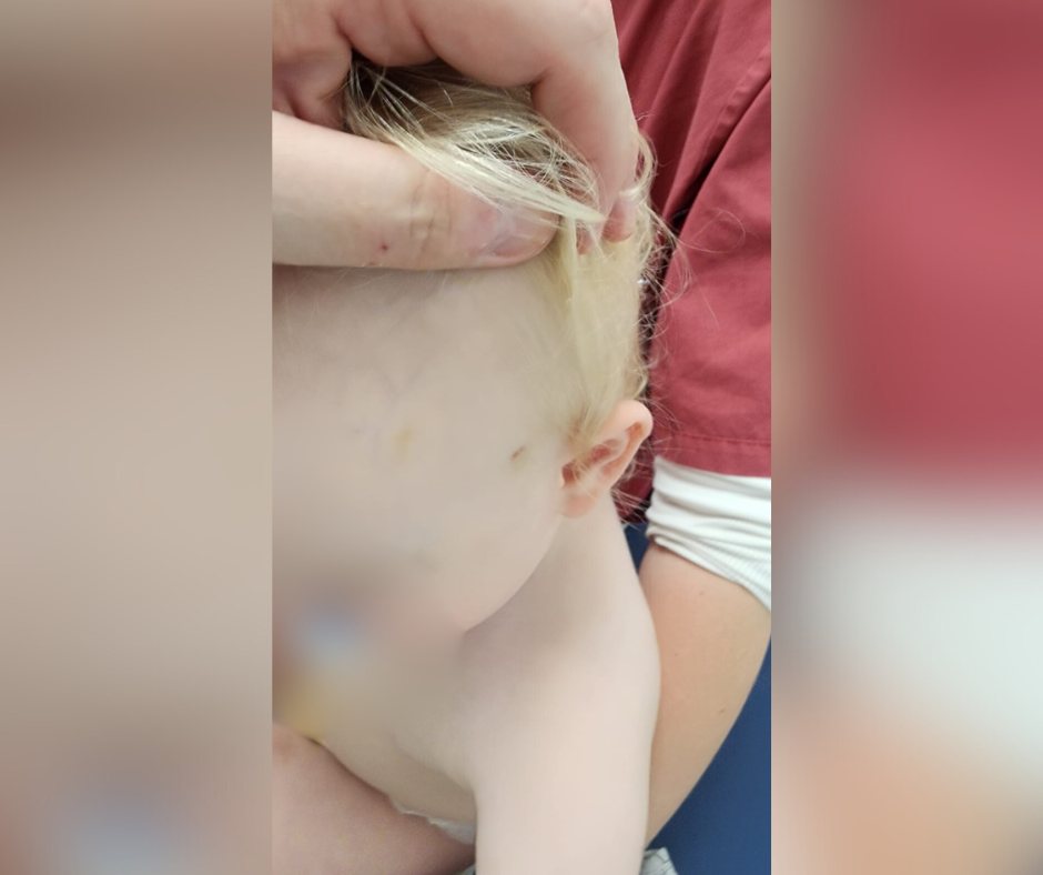 החבלה על פניו של הפעוט. קרדיט: צילום פרטי