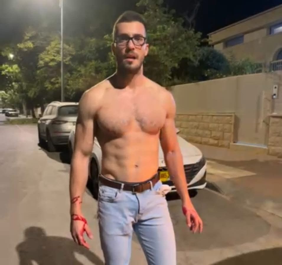 אדריאן לאחר המקרה, עם דמו של כלבו על ידיו. קרדיט - צילום פרטי