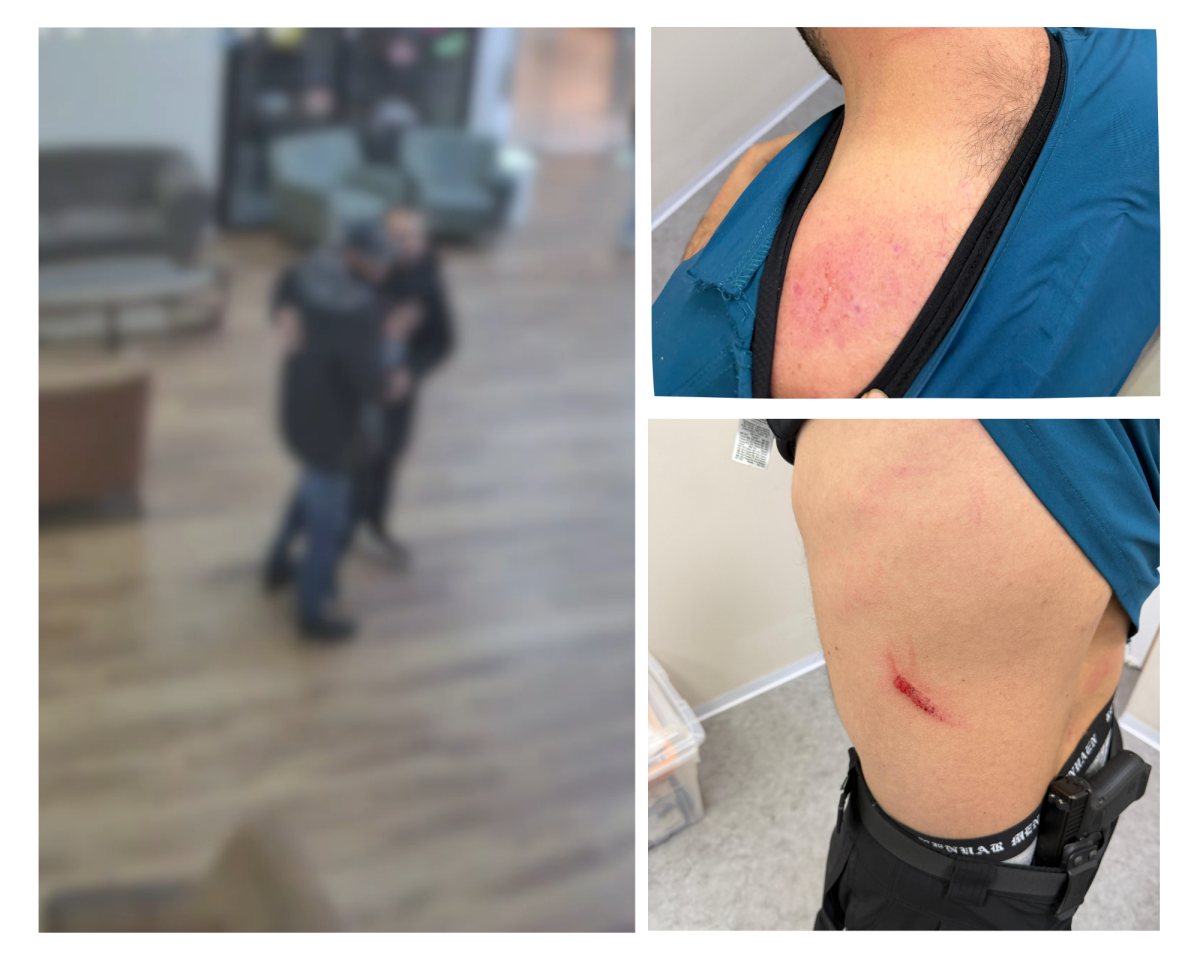 הפגיעות שספג הרופא והחשוד. קרדיט: צילום פרטי