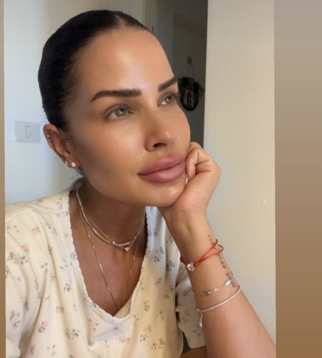 אודליה סויסה מתאוששת. צילום: מתוך אינסטגרם