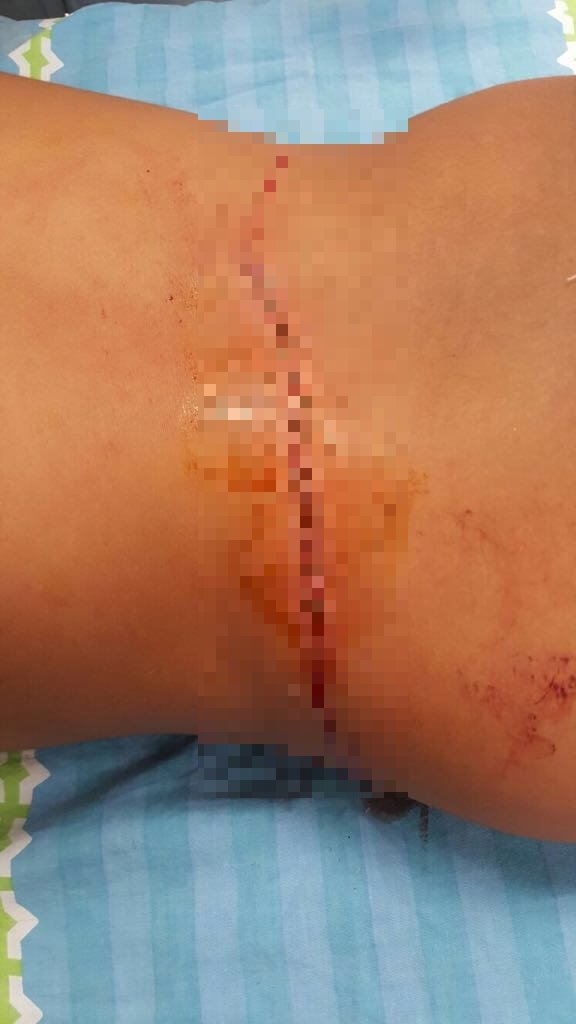 אחד הפצועים רדף אחרי ליצן ונדקר מסכין שנשא עליו. צילום: ווטסאפ