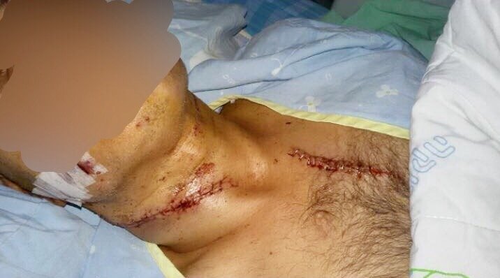 אחד הפצועים. צילום- עופר כהן מתוך הפייסבוק