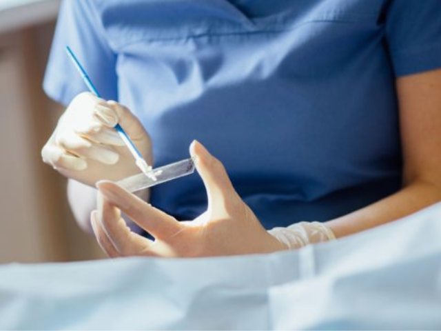 איתור סרטן צוואר הרחם (צילום: אילוסטרציה)