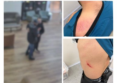 הפגיעות שספג הרופא והחשוד. קרדיט: צילום פרטי